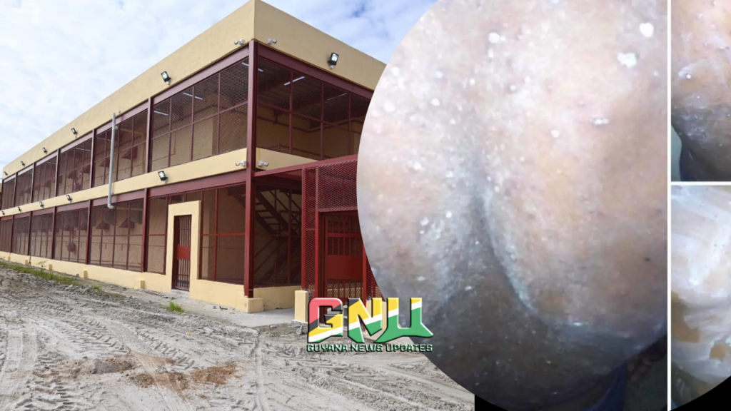 Lusignan Prison Remains Free of New Chickenpox Cases